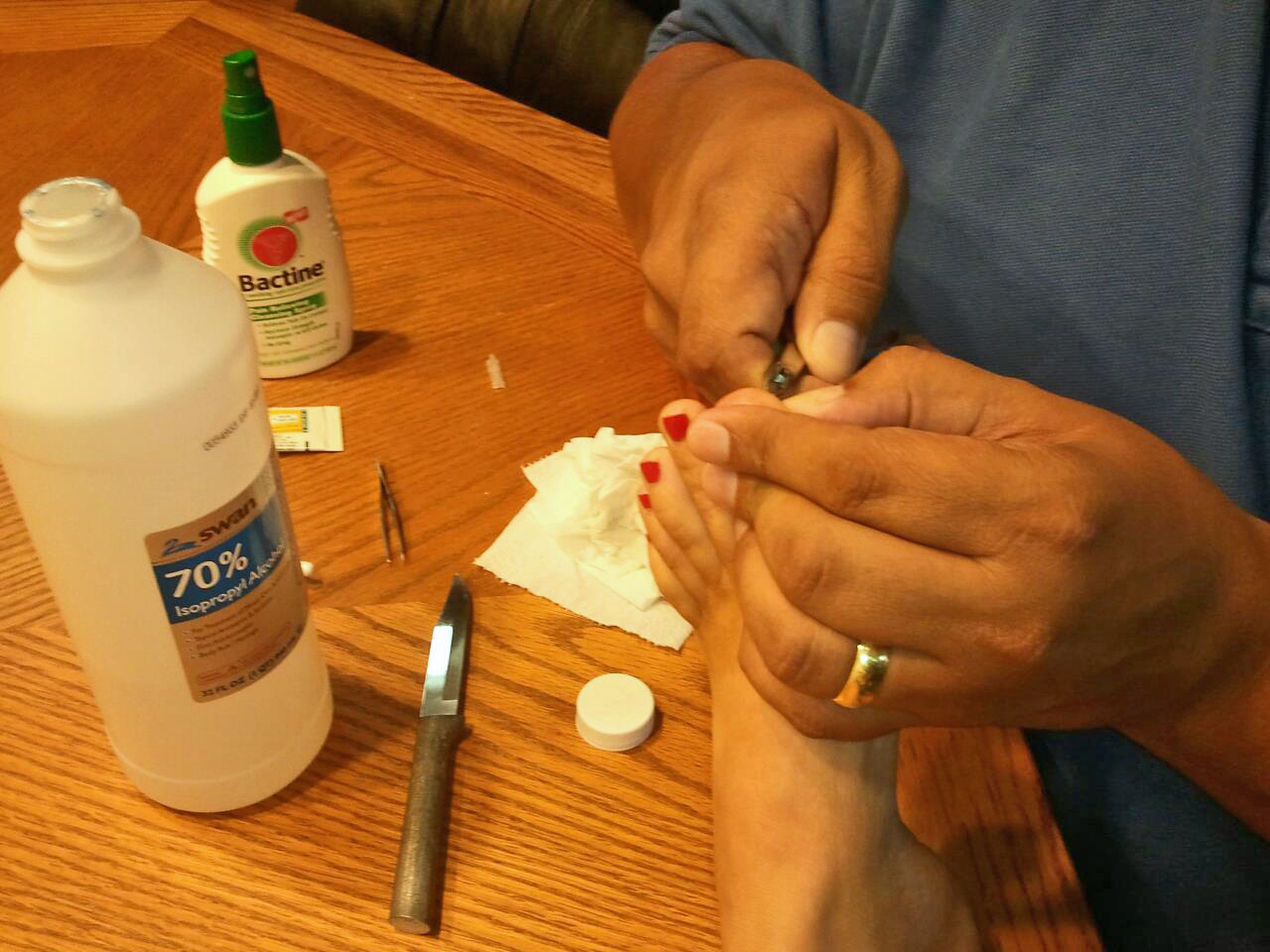 The Flip Flop Splinter Wars That'll Learn Ya! Shawna Coronado